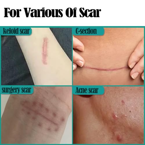 2 Rolls Silicone Scar Sheets Tape 1.6x120in Silicone Tape for Surgical Scars Patches Keloids Acne Burns Removal Sheets Reusable Professional