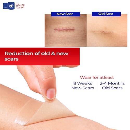 GauzeCare Silicone Scar Tape ? 1.6¡±x60¡± Roll ? Medical-Grade, Reusable, Professional Silicone Scar Tape for surgical scars, C-Section, Burns, Keloid, and Acne Scars