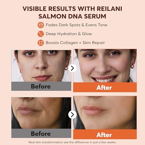 PDRN Salmon DNA Serum ? Anti-Aging Face Serum with Hyaluronic Acid, Tripeptide & Vitamins (10,000ppm) ? Hydrating Facial Serum for Blemishes, Collagen Boost & Fine Lines ? Korean Skincare ? 1 Fl Oz