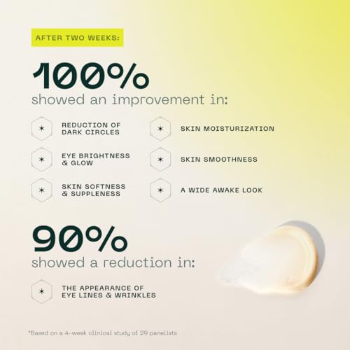 Aramore NAD+ Renewing Eye Cream with Retinol - Brightens Dark Circles, De-Puffs, Smooths Lines, Hydrates, & Energizes Under-Eye Area - 15ml
