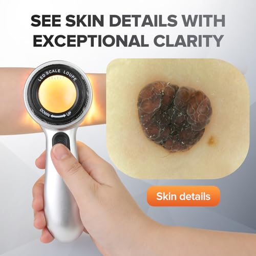 Portable Dermatoscope 30x Magnification with 4 LED Lights