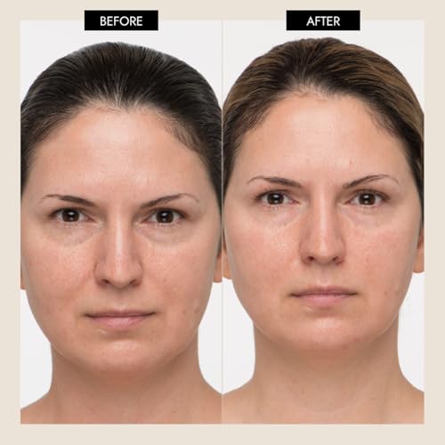MYOLIFT Mini Microcurrent Facial Device Kit – Wrinkle Reduction