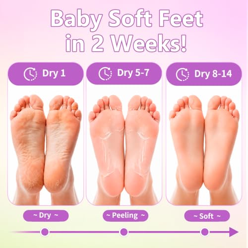 ANKOOY Exfoliating Foot Peeling Mask 6-Pack for Calluses & Dry Heels