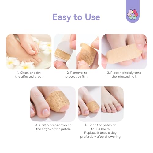 SAVILAND 1% Tolnaftate Fungal Nail Patches - Overnight Repair (32 Pcs)