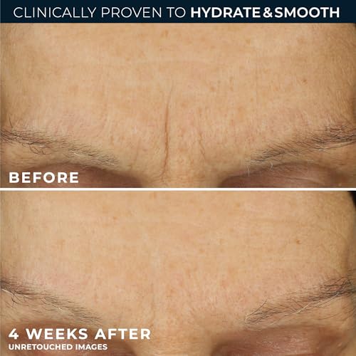 RoC Retinol Correxion Max Hydration Anti-Aging Face Moisturizer