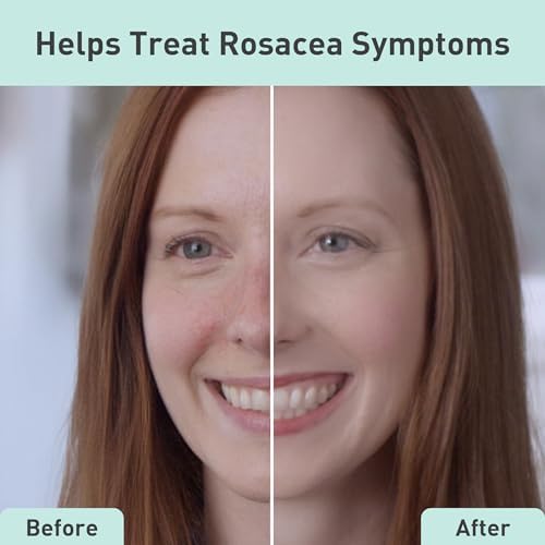 Rosacare Cleanser