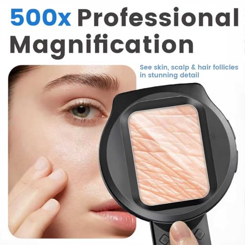 Digital Dermatoscope Skin Analyzer with 2.8" IPS Screen & 500X Magnification