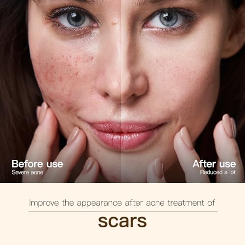 Madagascar Centella, Facial Serum for face, Natural Extraction of Bakuchiol, Centella Asiatica Extract for Soothing Sensitive& Acne-Prone Skin, for Scars, Moisturizing& Firming- 45ml