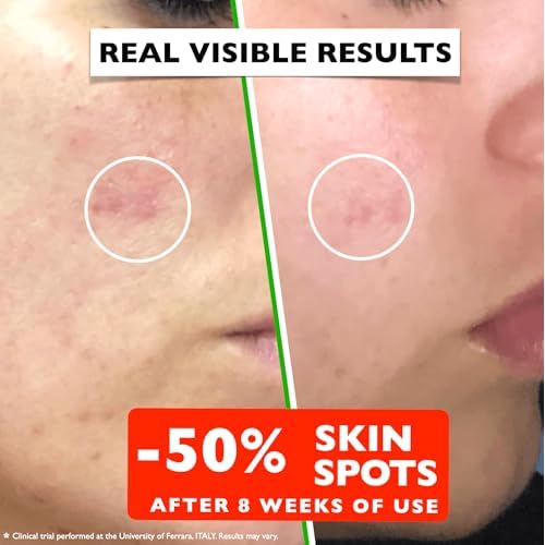 Vitamin C Serum For Face ? Anti Aging Face Serum with Vitamin C, Hyaluronic Acid, Vitamin E. Brightening Formula. Improve Appearance of Dark Spots, Tone, Fine Lines & Wrinkles, Glowing Skin 2 Fl Oz