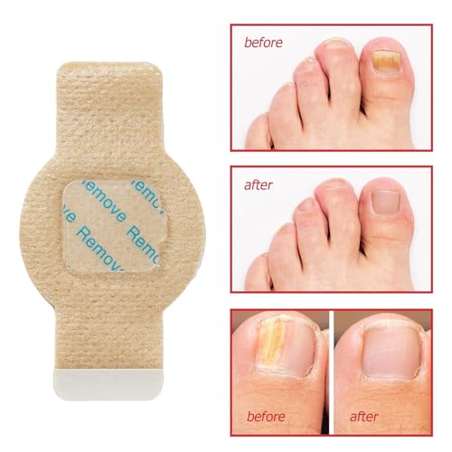 Frovetani Overnight Nail Treatment Patches - Extra Strength Repair (21 Pcs)