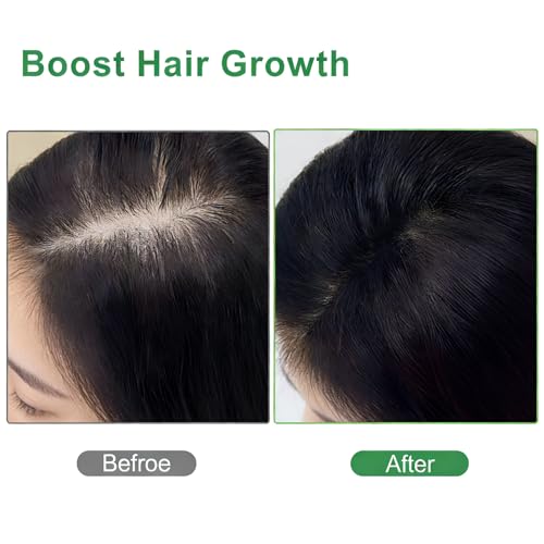 Jamaican Black Castor Oil for Hair Growth & Lashes