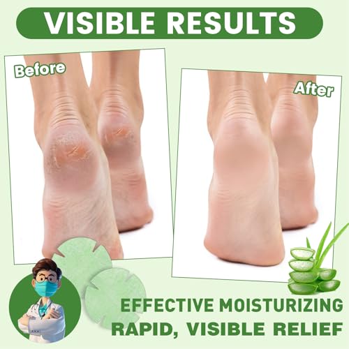TEAWOO Aloe Vera Cracked Heel Patches - Heel Repair & Moisturizing Bandages