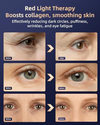 Red Light Therapy Glasses for Under Eye Treatment, Collagen Boost & Skin Rejuvenation