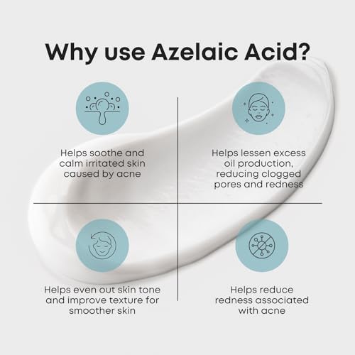 Azelaic Acid 10% - SoCalm Rosacea Relief for Face, Redness & Acne, Soothes Irritation & Suited for All Skin Types