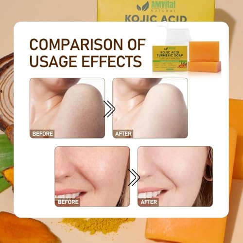 AMVital Turmeric Kojic Acid Soap Bars with Vitamin C, Retinol & Hyaluronic Acid ? Face & Body Soap with Collagen & Shea Butter ? 4-Pack Cleansing Bars for All Skin Types