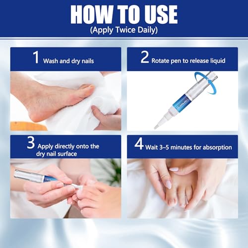 Toenail Fungus Treatment Pen - 25% Undecylenic Acid