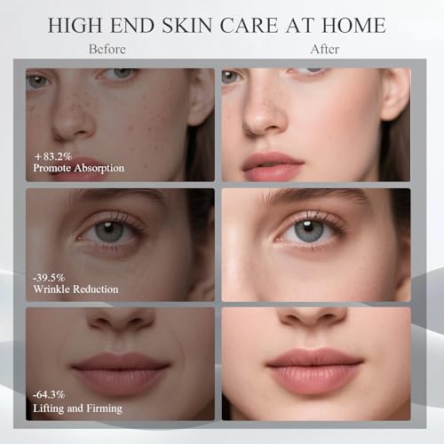 BNU Microcurrent & Red Light Facial Massager for Skin Lifting & Firming