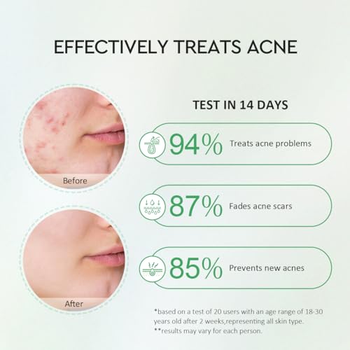 Centella Clarifying Serum for Face, Salicylic Acid & Niacinamide