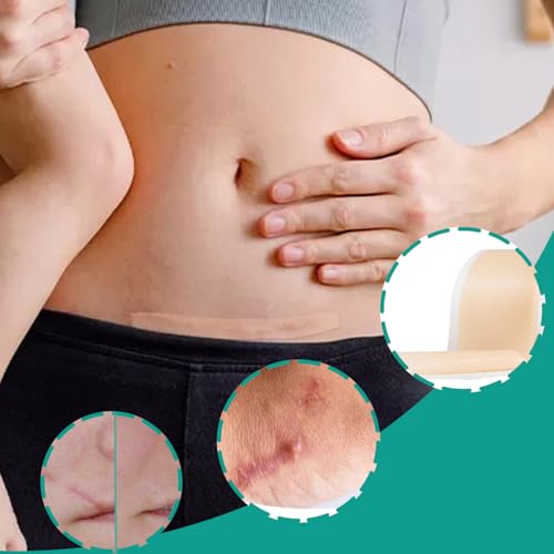 2 Rolls Silicone Scar Sheets Tape 1.6x120in Silicone Tape for Surgical Scars Patches Keloids Acne Burns Removal Sheets Reusable Professional