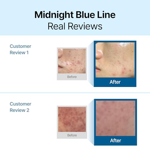DearKlairs Midnight Blue Calming Cream - Sensitive Skin Moisturizer 0.7oz