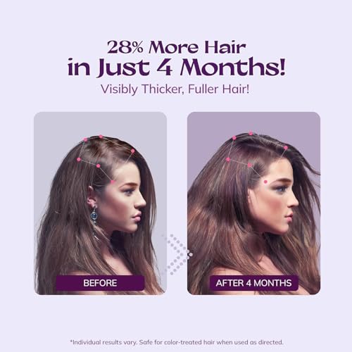 Women's 5% Minoxidil Spray for Hair Growth & Regrowth
