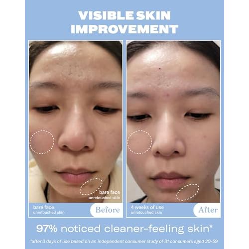 Then I Met You Soothing Tea Cleansing Gel, Vegan-Cruelty-Free Korean Skincare Cleanser with Fermented Rice, Centella, Hydrating Licorice, Glycerin, Exfoliator for Clear Skin Makeup Removal, 3.38 oz