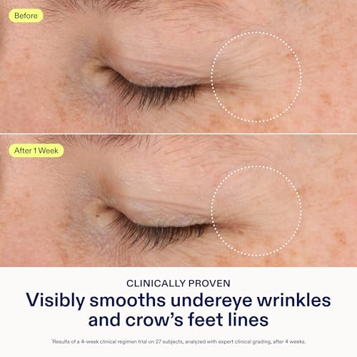 Skinfix Triple Lipid-Boost 360 Eye - 0.5 fl oz - Visibly Smooths Undereye Wrinkles & Crow¡¯s Feet Lines with Hyaluronic Acid - Non-Comedogenic - Vegan, Cruelty Free - Founded in Canada