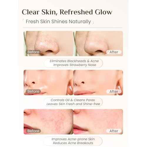 Rena Chris 3 Pcs Silicone Face Scrubber, 3 in 1 Face Mask Applicator & Facial Cleansing Brush, Pore Brush for Exfoliating, Blackhead, Skincare Applicator Tools