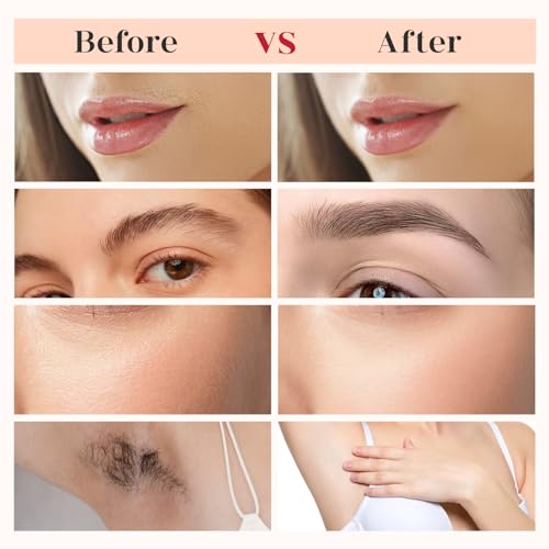 BECHY Gen 3 Gold Replacement Heads for Flawless Facial Hair Remover - 4 Pack