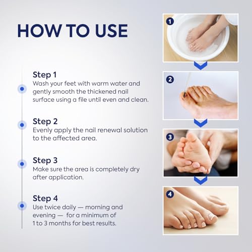 Toenail Fungus Treatment 25% Undecylenic Acid & Tea Tree Oil