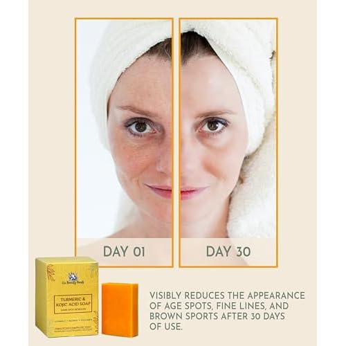 Original Kojic Acid Dark Spot Remover Soap Bars with Vitamin C, Retinol, Collagen, Turmeric Infused with Hyaluronic Acid, Vitamin E, Shea Butter, Olive Oil- 1 Bar
