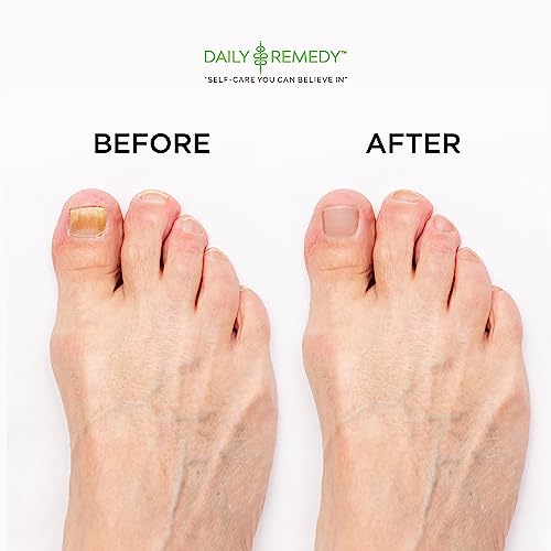 Daily Remedy Extra Strength Tea Tree Oil Foot Soak with Epsom Salt - 16 oz