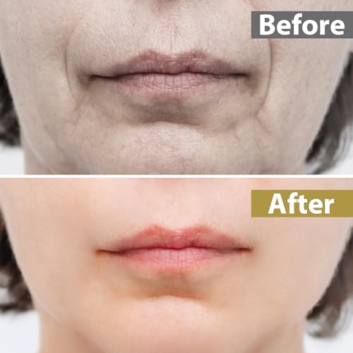 Lip Wrinkle Patches - Anti-Aging Silicone for Smile Lines