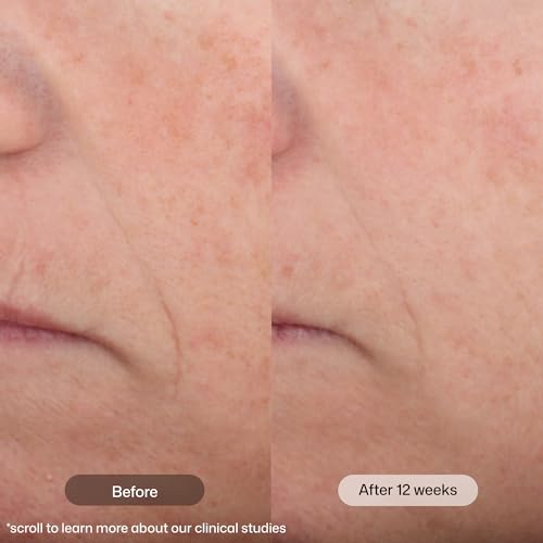Intellishade Matte SPF 45 Tinted Sunscreen | Oil-Free Daily Moisturizer