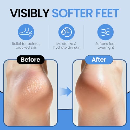 Silicone Moisturizing Socks for Dry Cracked Feet - Size 12