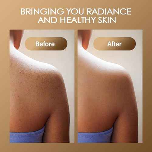 Turmeric Body Scrub Vitamin C Exfoliating Body Scrub With Collagen And Coconut Oil Body Exfoliator Dead Skin Remover Smooth And Hydrated Natural Scrub For Butt Bikini Area With Loofah