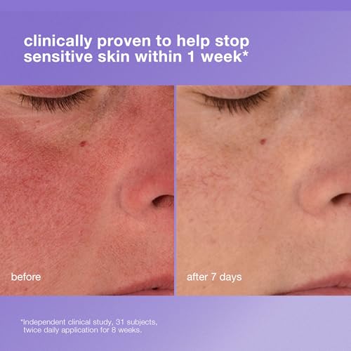 Dermalogica Stabilizing Repair Cream, Face Moisturizer for Sensitive Skin with Cica - Strengthens, Soothes, and Repairs Skin Barrier