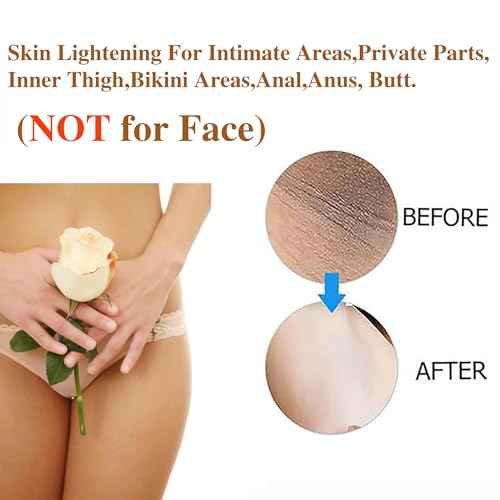 Intimate Areas Skin Lightening Cream for Private Parts, Underarm, Intimate Area, Bikini Area, Inner Thighs, Knees, Elbows, Bleach Skin Bleaching Whitening Cream For Body