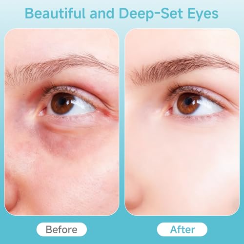 Depuffing Wand for Face & Eyes – Cold & Heat Facial Massage Tool