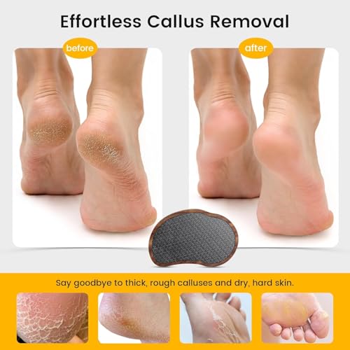 BEZOX Nano Glass Foot File Callus Remover with Walnut Wood Handle