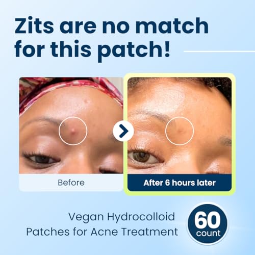 CLEAN SKIN CLUB 60 Invisible Vegan Pimple Patches, Derma Dot Hydrocolloid for Covering Zits, Blackhead, Blemish, Absorbing Face Cover Sticker, Skincare Treatment, Non Toxic Ingredients