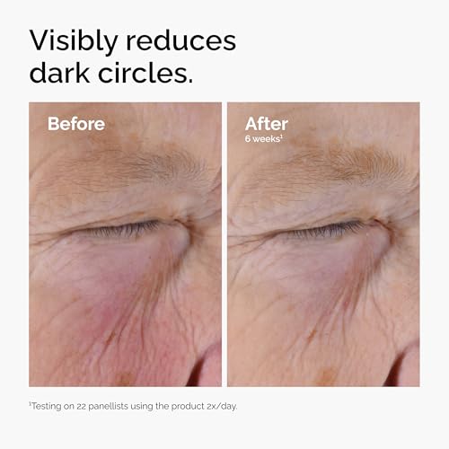 The Ordinary Caffeine Solution 5% + EGCG Eye Serum 1 Fl Oz – Depuffs Tired Eyes & Dark Circles