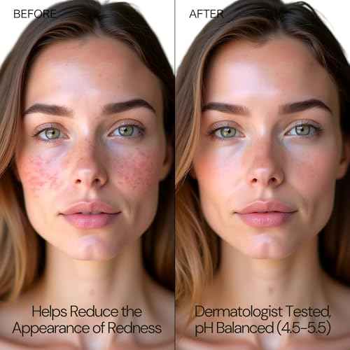 BodyJ4You Hypochlorous Acid Spray for Face Cleaner - HOCL Facial Toner Acne Sensitive Skin - HOCL Molecule Spray Topical Skin Redness Relief Breakouts - Piercing Aftercare Solution Fine Mist - 4 Fl Oz