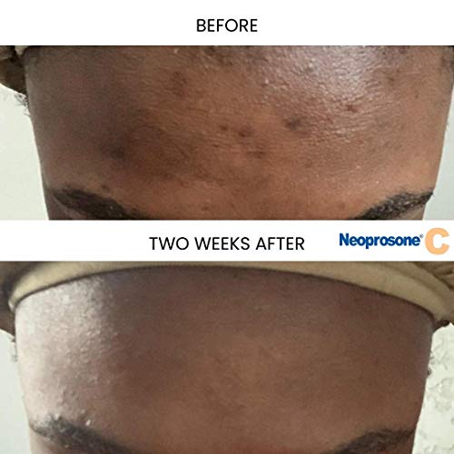 Neoprosone, Vitamin C Serum for Face | 1 Fl oz / 30ml | Brightening Serum For Dark Circle, Wrinkles | with Alpha Arbutin and Castor Oil