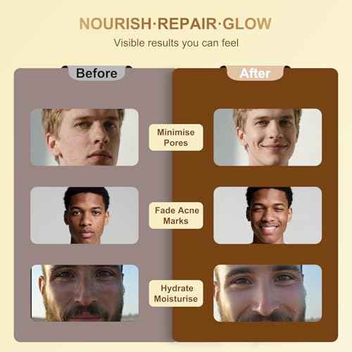 Beef Tallow for Skin, Grass Fed Beef Tallow Honey Balm for Men, Honey Face Moisturizer Skin Care for Face and Body, Hydrating Anti Aging, Unscented, 2oz