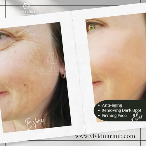 Vivid Ultra Vitamin C Serum for Face ? Anti-Aging Serum with Hyaluronic Acid, Collagen & Vitamin E ? Brightening Dark Spots, Firming Skin, Reducing Wrinkles & Acne Scars ? 1 Fl Oz