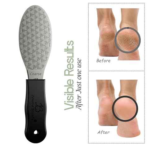Stainless Steel Foot File with Silicone Grip ? Professional Pedicure & Callus Remover, Surgical-Grade Foot Scrubber for Dead Skin & Cracked Heels, Safe for Diabetics, Autoclavable, 2-Year Warranty