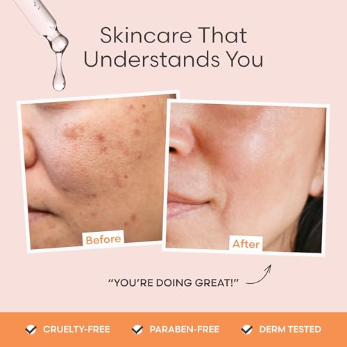 Vitamin C Serum for Face by Outofshell Beauty ? 4-in-1 with Real Retinol, Hyaluronic Acid, Niacinamide ? Brightening, Evens Skin Tone, Lightweight, No Irritation
