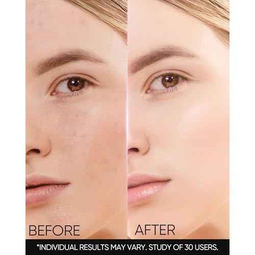 MSH Niacinamide Brightening Cream,Fades Dark Spots, Evens Skin Tone, Tranexamic Acid, ¥á-Arbutin, 5X Ceramides, Centella Asiatica, Suitable for Oil skin, 1fl.oz / 30g