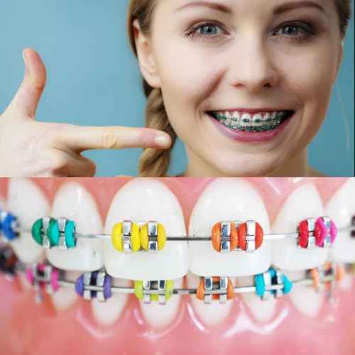 1040 Pcs Multi-Color Rubber Bands, Orthodontic Ligature Ties Kit - O-rings Braces Dental Ties for Orthodontic Procedures and Dental Braces (40 items)